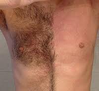 Stoppels_vergelijking